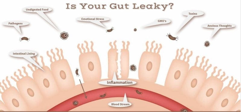 What IS Leaky Gut